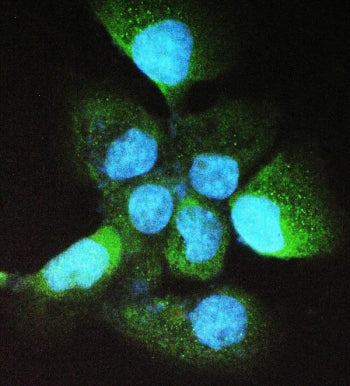 Immunofluorescent staining of FFPE human A431 cells with ADH5 antibody. HIER: boil tissue sections i