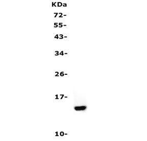 Western blot testing of Cystatin A antibody and human A431 cell lysate. Predicted molecular weight ~