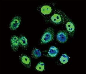 SMAD4 Antibody (phospho-T277)