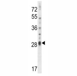 IL17D Antibody