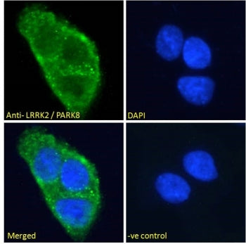 IF/ICC staining of fixed and permeabilized human A431 cells with LRRK2 antibody (green) at 10ug/ml a