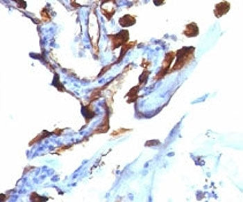 Cytokeratin 8/18 Antibody