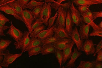 MED26 Antibody / Mediator of RNA polymerase II transcription subunit 26