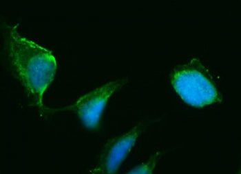 HSD3B1 Antibody