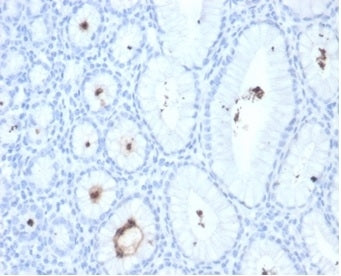 IHC staining of FFPE human H. pylori-infected stomach tissue with Helicobacter pylori antibody (clon