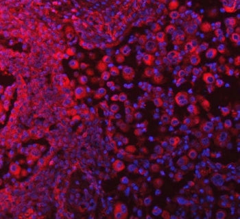 Immunofluorescent staining of FFPE human lung tissue with SELT antibody (red) and DAPI nuclear stain