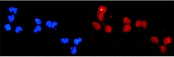 DDB2 Antibody