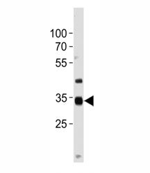 NKX3.2 Antibody