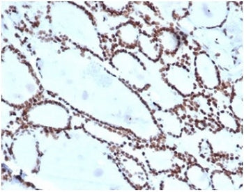 HOXB2 Antibody