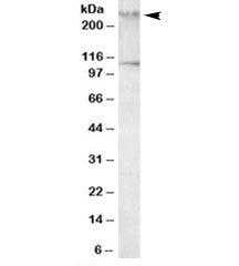 Western blot testing of human peripheral mononucleocytes lysate with Talin 1 antibody at 1ug/ml. The