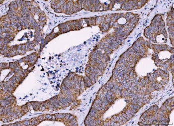 MRPS18B Antibody / 28S ribosomal protein S18b, mitochondrial