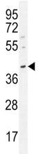 Oct3/4 antibody western blot analysis in MDA-MB231 lysate. Predicted molecular weight ~38/30kDa (iso