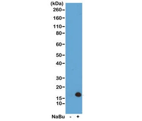 H3K4ac Antibody / Acetyl Histone H3 Lysine 4