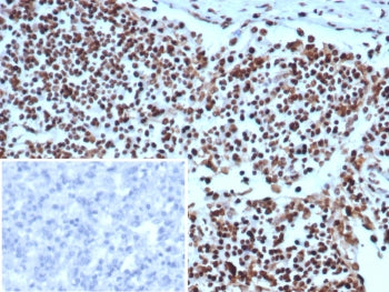 Ku80 Antibody / XRCC5