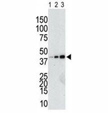 Anti-GST antibody used in western blot to detect a GST-tagged recombinant protein purified from bact