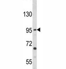 TLR3 Antibody