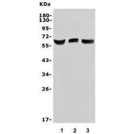 Western blot testing of 1) human HEK293, 2) monkey COS-7 and 3) human HK-2 lysate with Arylsulfatase