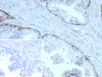 Cytokeratin 14 Antibody / CK14 / KRT14
