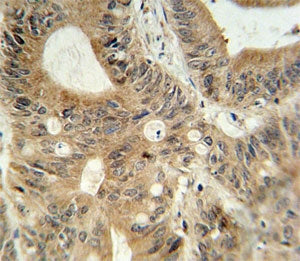 ABCC3 Antibody