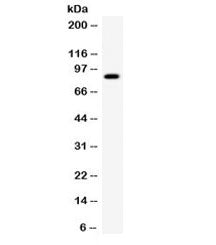Western blot testing of human SMMC cell lysate with SMURF2 antibody. Expected/observed molecular wei