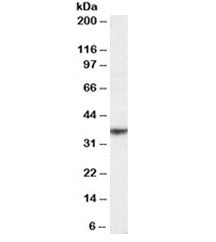 NKG2D Antibody