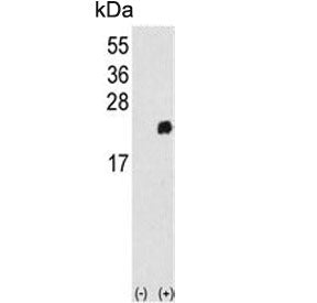 Peroxiredoxin 1 Antibody / PRDX1