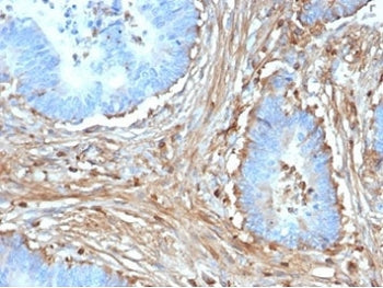 Fibrillin-1 Antibody / FBN1