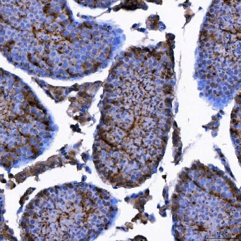 TRIM71 Antibody / LIN41