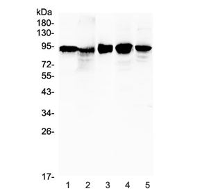 Western blot testing of 1) human placenta, 2) human A431, 3) human SK-OV-3, 4) rat heart and 5) mous