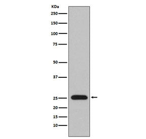 Lambda Light Chain Antibody / Lambda Antibody