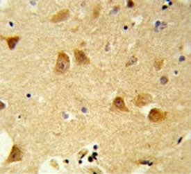 IHC testing of FFPE human brain tissue with Derlin 1 antibody. HIER: steam section in pH6 citrate bu
