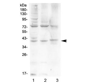 HFE Antibody (Hereditary hemochromatosis protein)