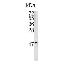 Western blot testing of human HEK293 cell lysate with Caveolin-3 antibody. Predicted molecular weigh