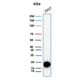Western blot testing of human 293T cell lysate with recombinant Survivin antibody (clone BIRC5/8936R
