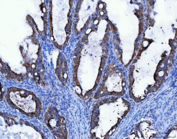 TFG Antibody / TRK fused gene protein