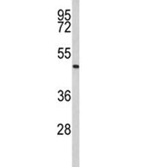 Western blot analysis of Acrosin antibody and human Jurkat lysate. Predicted molecular weight ~46 kD