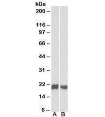 CD3D Antibody