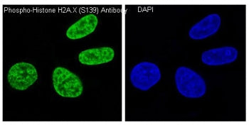 Histone H2AX Antibody (pS139)