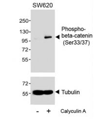 Beta Catenin Antibody (pS33/37)
