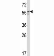 Beclin-1 Antibody