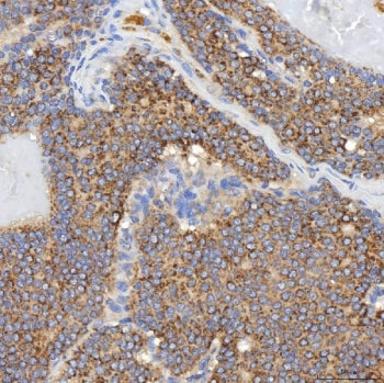SGCE Antibody / Epsilon-sarcoglycan