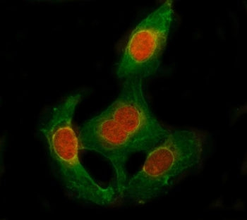Immunofluorescent staining of FFPE human U-2 OS cells with PA26 antibody (red) and Beta Tubulin mAb 