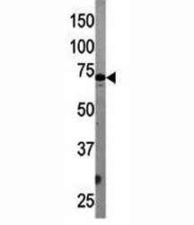 ATG7 Antibody (APG7)