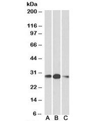 HOXA5 Antibody