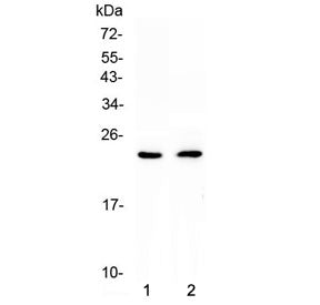 Western blot testing of 1) rat heart and 2) mouse heart lysate with FNDC5 antibody at 0.5ug/ml. Pred