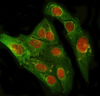 PRDM2 Antibody / RIZ1