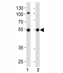Parkin Antibody