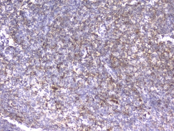 ITGB2 Antibody