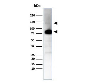 Western blot testing of human ovary tissue lysate using recombinant CAD antibody (clone CALD1/7024R)