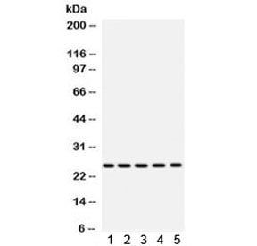 Superoxide Dismutase 2 Antibody / SOD2